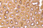 TUSC1 Antibody in Immunohistochemistry (Paraffin) (IHC (P))