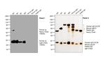 Human IgG F(ab')2 Cross-Adsorbed Secondary Antibody in Western Blot (WB)