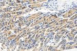 RAB13 Antibody in Immunohistochemistry (Paraffin) (IHC (P))
