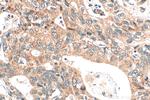 DPCR1 Antibody in Immunohistochemistry (Paraffin) (IHC (P))