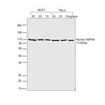 Human IgG (H+L) Cross-Adsorbed Secondary Antibody in Western Blot (WB)