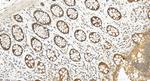 NDRG3 Antibody in Immunohistochemistry (Paraffin) (IHC (P))