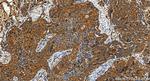 CORO7 Antibody in Immunohistochemistry (Paraffin) (IHC (P))