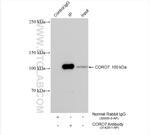CORO7 Antibody in Immunoprecipitation (IP)