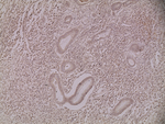 Mouse IgG (H+L) Secondary Antibody in Immunohistochemistry (Paraffin) (IHC (P))