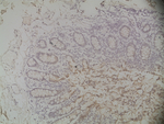 Mouse IgG (H+L) Secondary Antibody in Immunohistochemistry (Paraffin) (IHC (P))