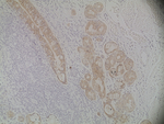 Mouse IgG (H+L) Secondary Antibody in Immunohistochemistry (Paraffin) (IHC (P))