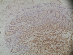 Mouse IgG (H+L) Secondary Antibody in Immunohistochemistry (Paraffin) (IHC (P))