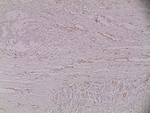 Mouse IgG (H+L) Secondary Antibody in Immunohistochemistry (Paraffin) (IHC (P))