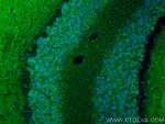SLC8A2 Antibody in Immunohistochemistry (Paraffin) (IHC (P))