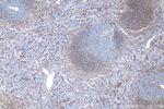 CD200 Antibody in Immunohistochemistry (Paraffin) (IHC (P))