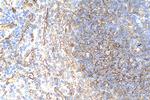CD200 Antibody in Immunohistochemistry (Paraffin) (IHC (P))