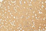CD200 Antibody in Immunohistochemistry (Paraffin) (IHC (P))