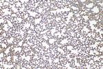 ICAM-1/CD54 Antibody in Immunohistochemistry (Paraffin) (IHC (P))