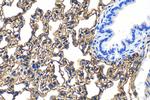 ICAM-1/CD54 Antibody in Immunohistochemistry (Paraffin) (IHC (P))