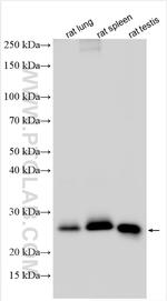Lipocalin-2/Ngal Antibody in Western Blot (WB)