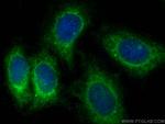 DAB1 Antibody in Immunocytochemistry (ICC/IF)