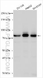 DAB1 Antibody in Western Blot (WB)
