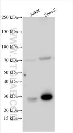 KIAA0323 Antibody in Western Blot (WB)