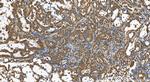 HSD17B12 Antibody in Immunohistochemistry (Paraffin) (IHC (P))