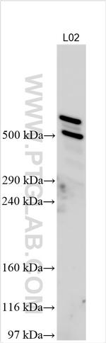 EPPK1 Antibody in Western Blot (WB)