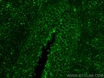 SLC38A7 Antibody in Immunohistochemistry (PFA fixed) (IHC (PFA))