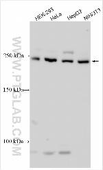 DNAJC13 Antibody in Western Blot (WB)