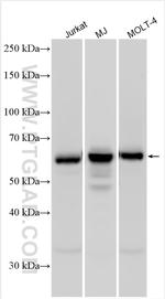 CD5 Antibody in Western Blot (WB)