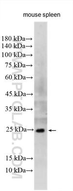 TNF Beta Antibody in Western Blot (WB)