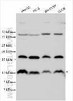 Adiponectin Antibody in Western Blot (WB)