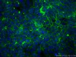CD9 Antibody in Immunocytochemistry (ICC/IF)