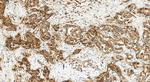CD9 Antibody in Immunohistochemistry (Paraffin) (IHC (P))