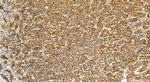 E-cadherin Antibody in Immunohistochemistry (Paraffin) (IHC (P))