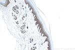 E-cadherin Antibody in Immunohistochemistry (Paraffin) (IHC (P))