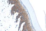 E-cadherin Antibody in Immunohistochemistry (Paraffin) (IHC (P))