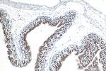 E-cadherin Antibody in Immunohistochemistry (Paraffin) (IHC (P))