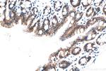 E-cadherin Antibody in Immunohistochemistry (Paraffin) (IHC (P))