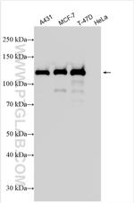 E-cadherin Antibody in Western Blot (WB)