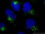 Cathepsin D Antibody in Immunocytochemistry (ICC/IF)