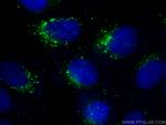 Cathepsin D Antibody in Immunocytochemistry (ICC/IF)