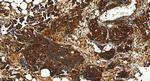 Cathepsin D Antibody in Immunohistochemistry (Paraffin) (IHC (P))