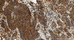 Cathepsin D Antibody in Immunohistochemistry (Paraffin) (IHC (P))