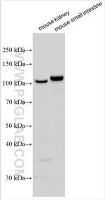 ACE2 Antibody in Western Blot (WB)