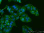 ARSE Antibody in Immunocytochemistry (ICC/IF)