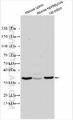 TMEM258 Antibody in Western Blot (WB)
