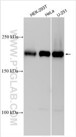 CDC42BPB Antibody in Western Blot (WB)