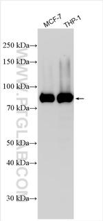 PPP1R21 Antibody in Western Blot (WB)
