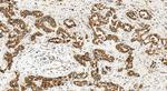 CXCL8/IL-8 Antibody in Immunohistochemistry (Paraffin) (IHC (P))