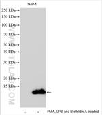 CXCL8/IL-8 Antibody in Western Blot (WB)