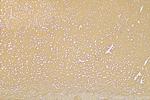 NCAM1/CD56 Antibody in Immunohistochemistry (Paraffin) (IHC (P))